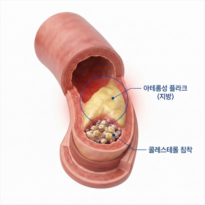 치료사례 썸네일 애프터.png